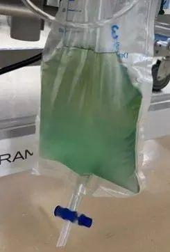 溢诚优配 陷入深昏迷！25岁小伙全身青紫，尿液呈“诡异蓝色”！医生：剧毒，0.5克可致命